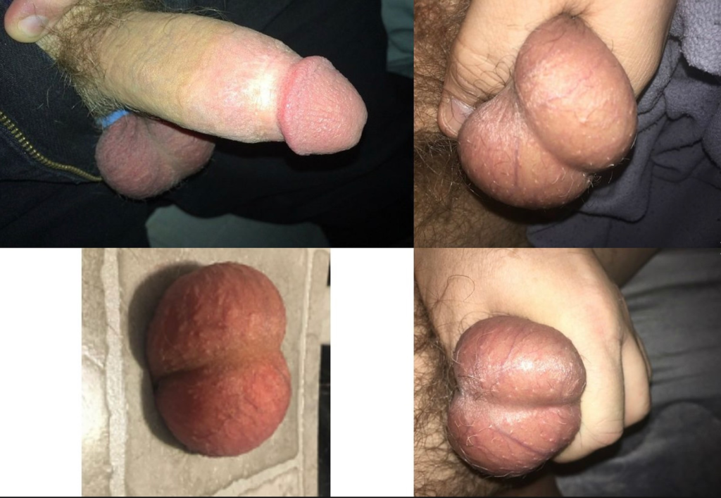 needs severe cbt and busting